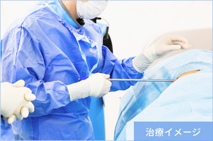 治療のイメージ